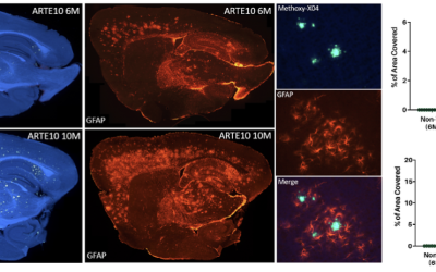 Neuroinflammation induite par la bêta-amyloïde dans des modèles de la maladie d'Alzheimer