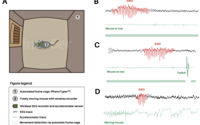 Enregistrement EEG dans le modèle d'encéphalopathie épileptique