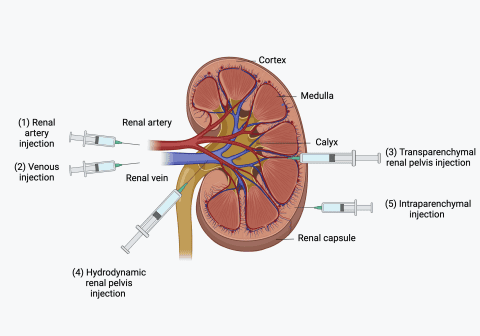 Targeted Kidney Gene Therapy Delivery - InnoSer - ADPKD Research
