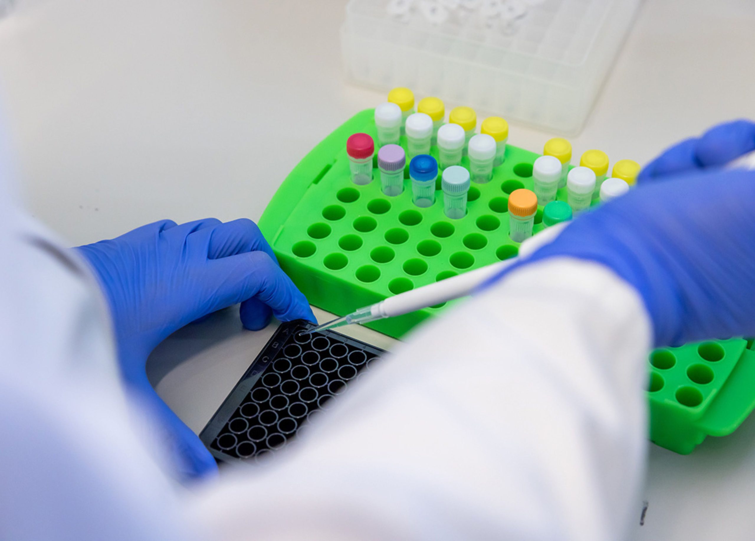 Histopathology stainings for reclinical cancer research studies testing toxicity of drugs in development