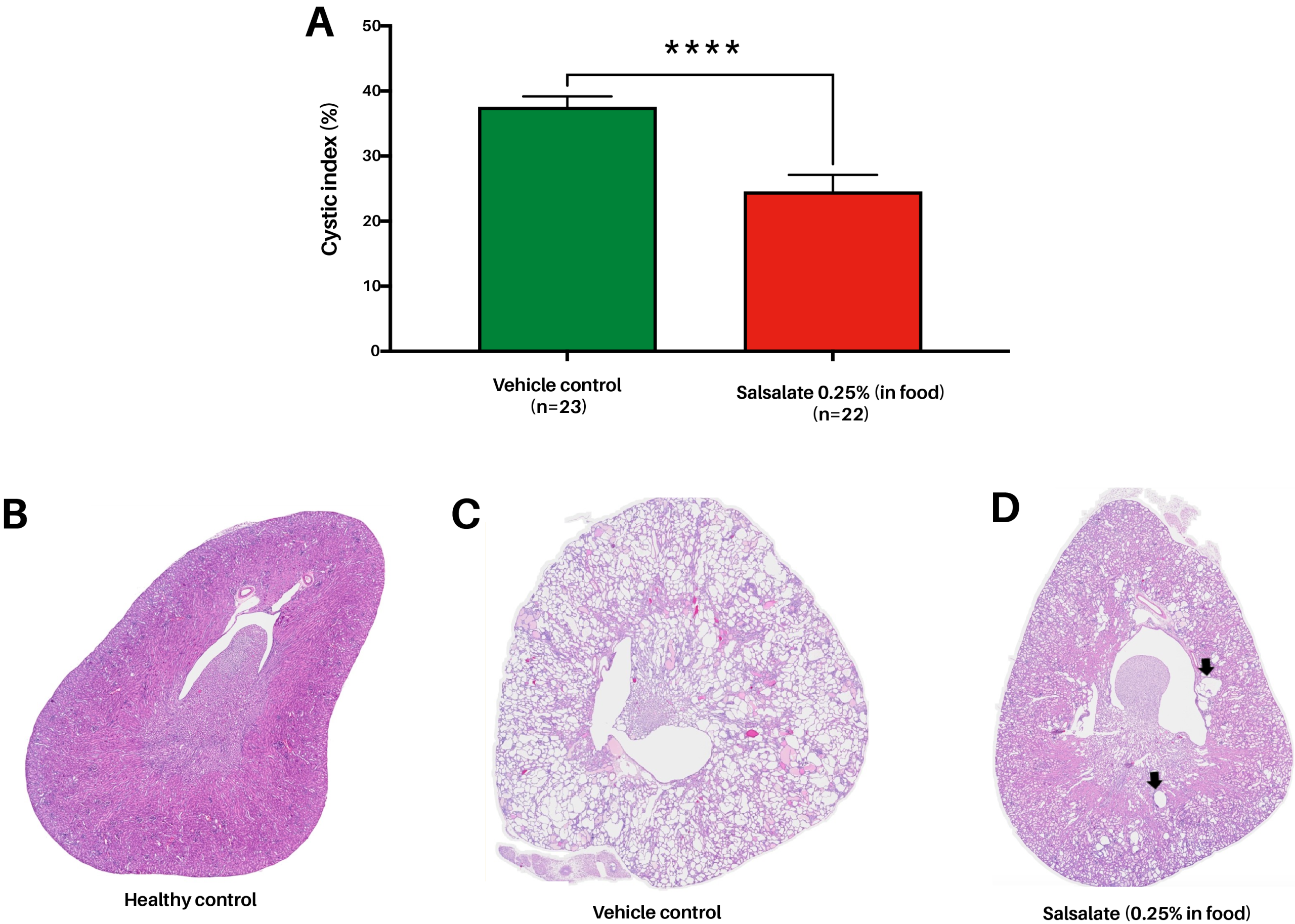 Figure showing bar graph and histopathology of kidneys obtained from the mouse model of ADPKD showing differences in cystic pathology typical of ADPKD between treated mice (Salsalate) and untreated mice. 