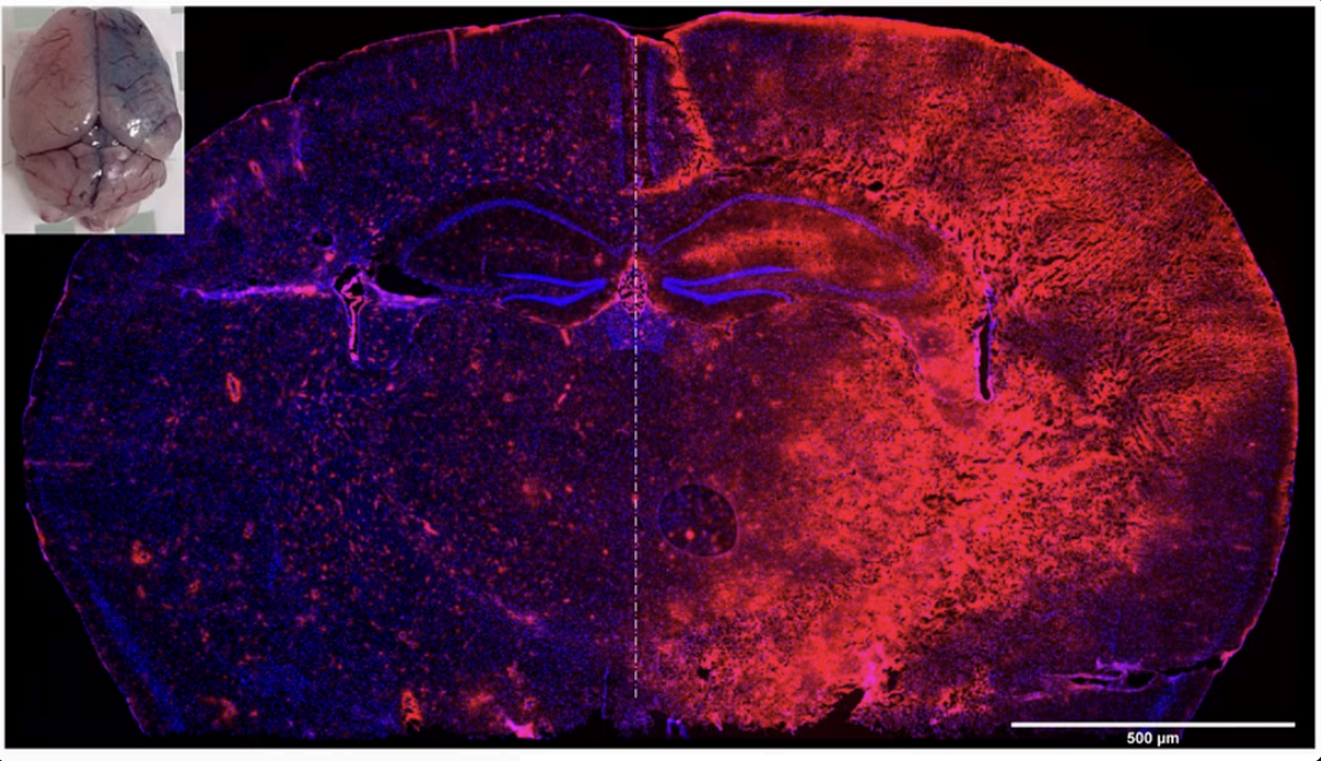 Example image highlighting blood-brain barrier opening following sonication of low-intensity pulsed ultrasound (LIPU) and intravenously administered microbubbles (MB) in mouse brain (figure shared with permission from original paper ￼  Ahmed et al., 2023)