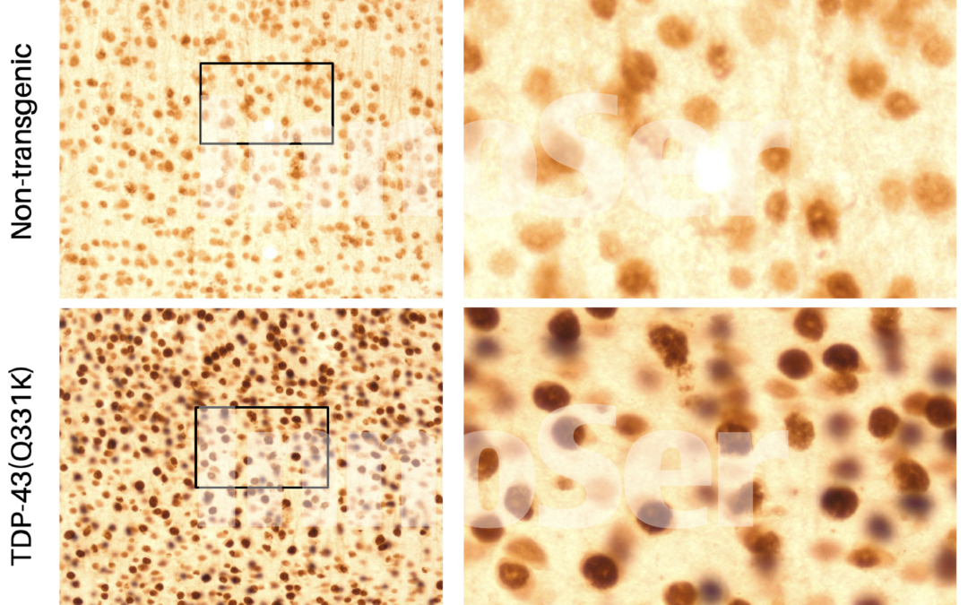Modelling TDP-43 proteinopathy and motor neuron disease pathophysiology in mouse models