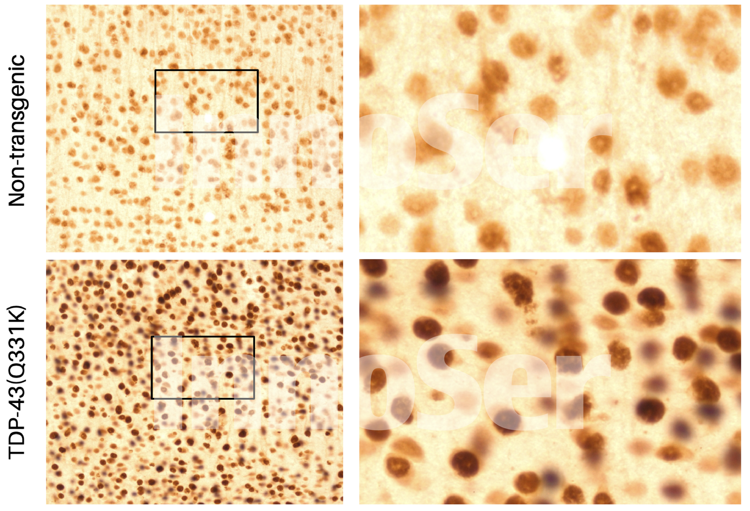 Histopathology image showing differences in TDP-43 signal in nucleus and cytoplasm in mutant vs healthy TDP-43 mouse model
